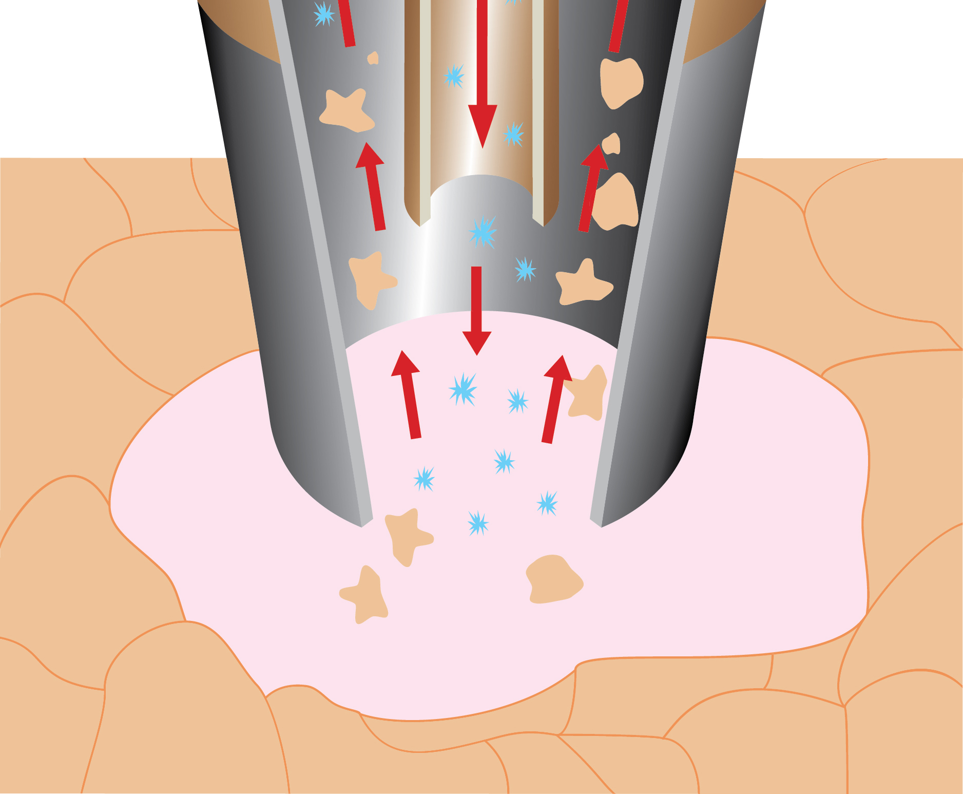 Pristine | Viora Med | DPS